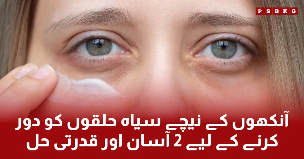 Best treatment for the dark circles under the eyes.