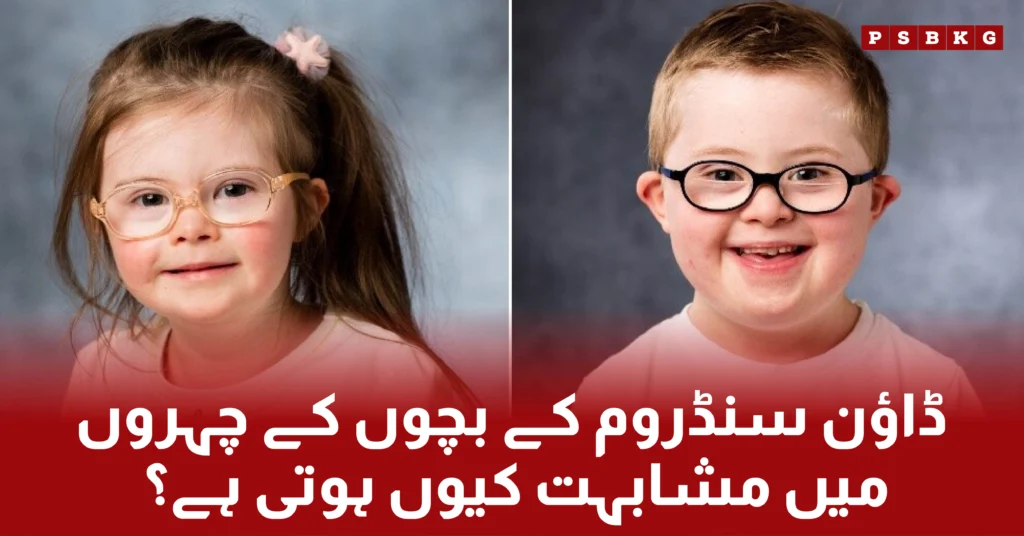 why down syndrome special children have same faces.