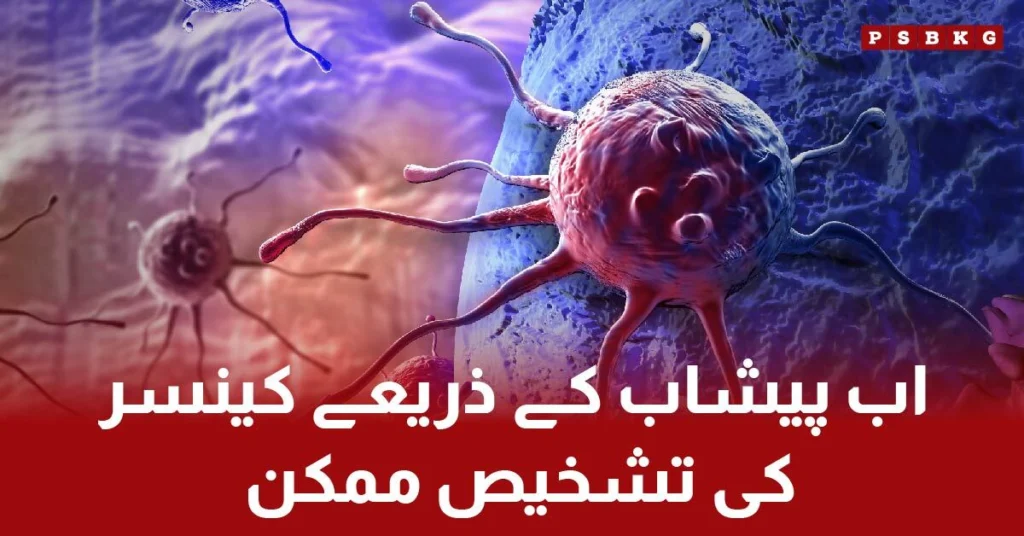 Scientists discover prostate cancer signs in urine