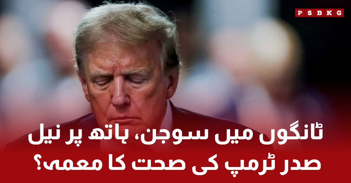 President Trump undergoing medical tests for leg swelling and hand bruise