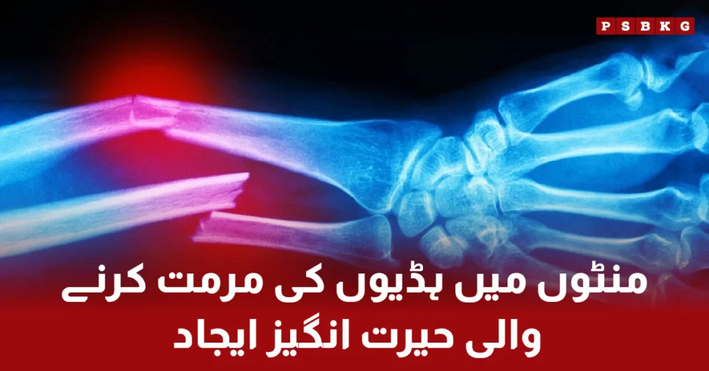 Chinese scientists invention Bone-02 bone glue