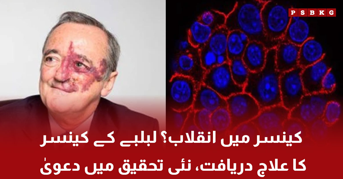 Pancreatic cancer treatment discovery in Spain