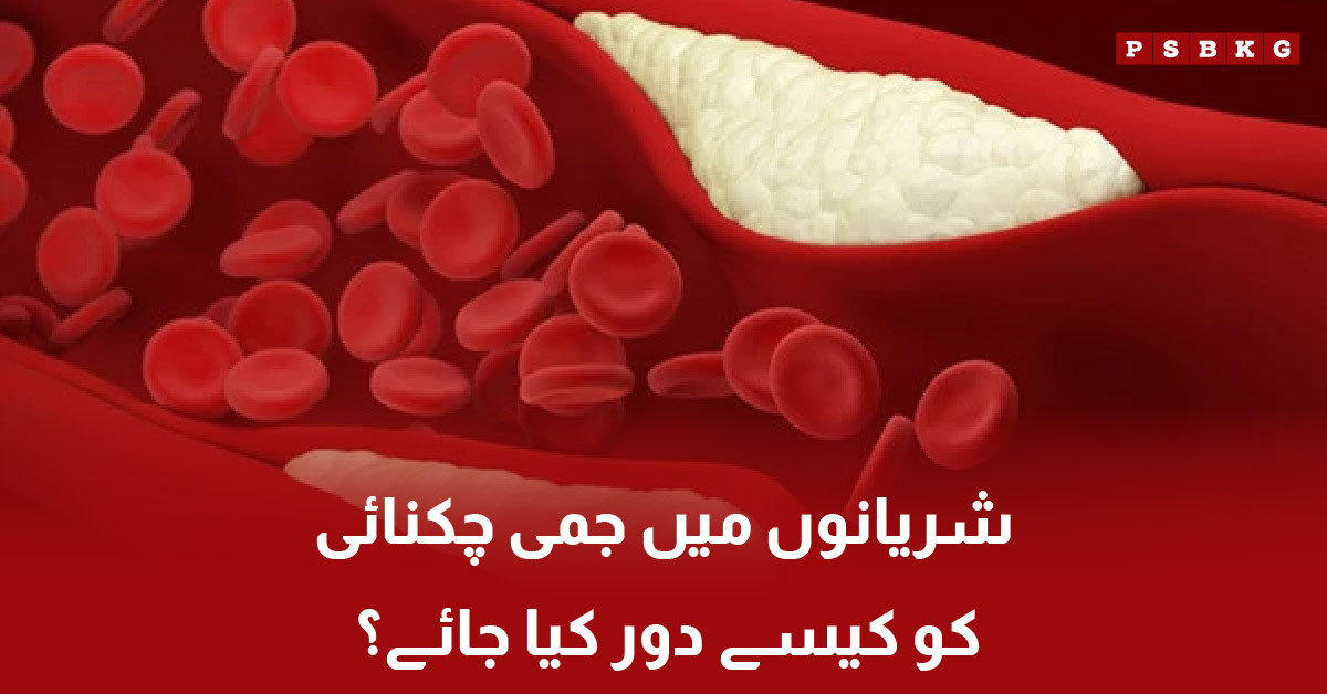 Tips to remove fat from arteries naturally