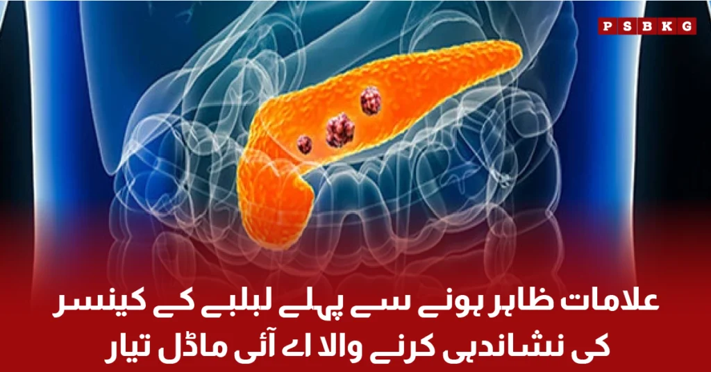 AI model detecting pancreatic cancer from CT scans early