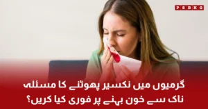 First aid for nose bleeding in summer with head forward position and ice application