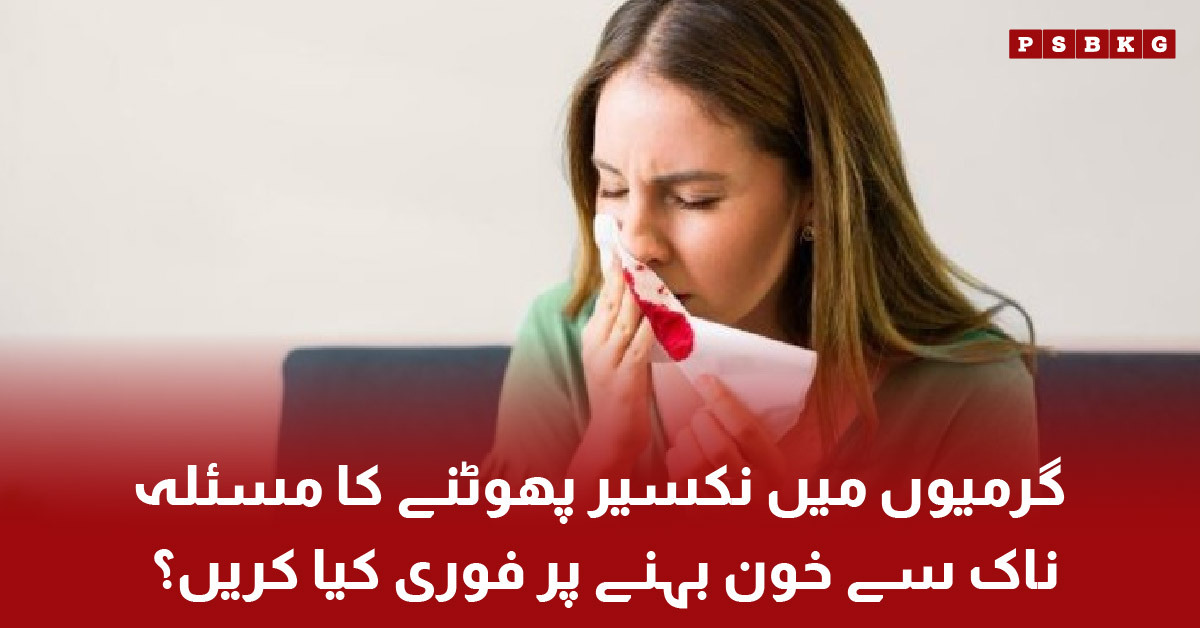 First aid for nose bleeding in summer with head forward position and ice application