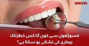 Bleeding gums may be an early warning sign of kidney disease according to new medical research.